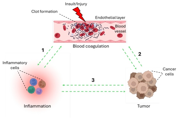Figure: Interconnection among blood coagulation, cancer, and inflammation.